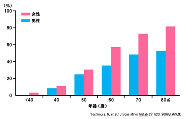 変形性膝関節症の年齢別有病率グラフ