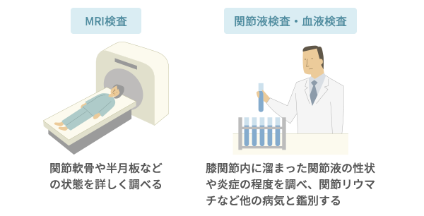 MRI検査、関節液検査・血液検査イメージ