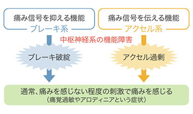 線維筋痛症の原因イメージ