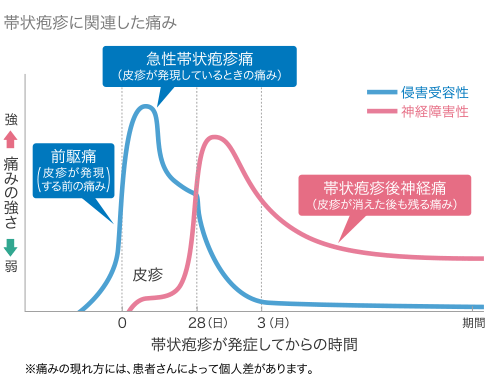 帯状疱疹に関連した痛みのグラフ