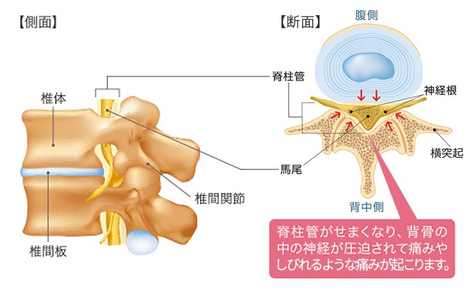 背骨イメージ　側面・断面図